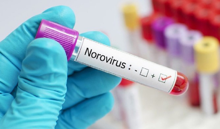Norovirus China Cina